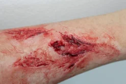 ForensicFX Studios Arm Lacerations/Cuts Prosthetic></noscript> Halloween Accessories