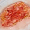 ForensicFX Studios Deep Fatty Tissue Wound Prosthetic> Halloween Accessories