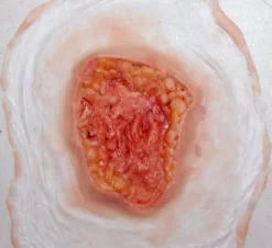 ForensicFX Studios Deep Fatty Tissue Wound Prosthetic><noscript><img width=