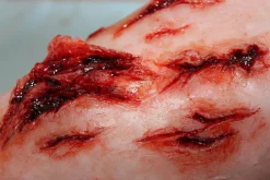 ForensicFX Studios Deep Leg Lacerations Prosthetic><noscript><img width=