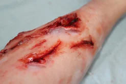 ForensicFX Studios Deep Leg Lacerations Prosthetic><noscript><img width=
