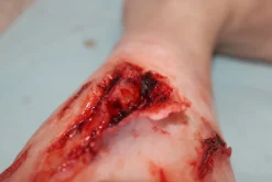 ForensicFX Studios Deep Leg Lacerations Prosthetic><noscript><img width=