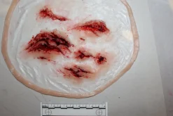 ForensicFX Studios Deep Leg Lacerations Prosthetic><noscript><img width=