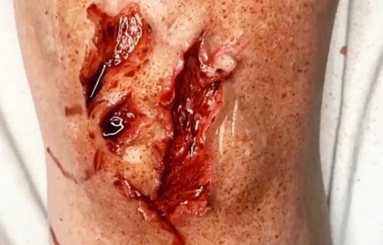 ForensicFX Studios Deep Opened Mangled Wounds Prosthetic> Halloween Accessories