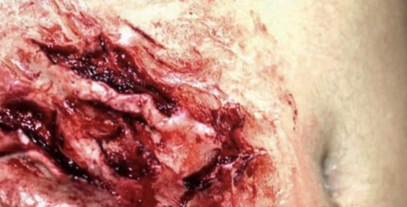 ForensicFX Studios Deep Opened Mangled Wounds Prosthetic> Halloween Accessories