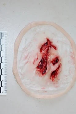 ForensicFX Studios Deep Opened Mangled Wounds Prosthetic><noscript><img width=