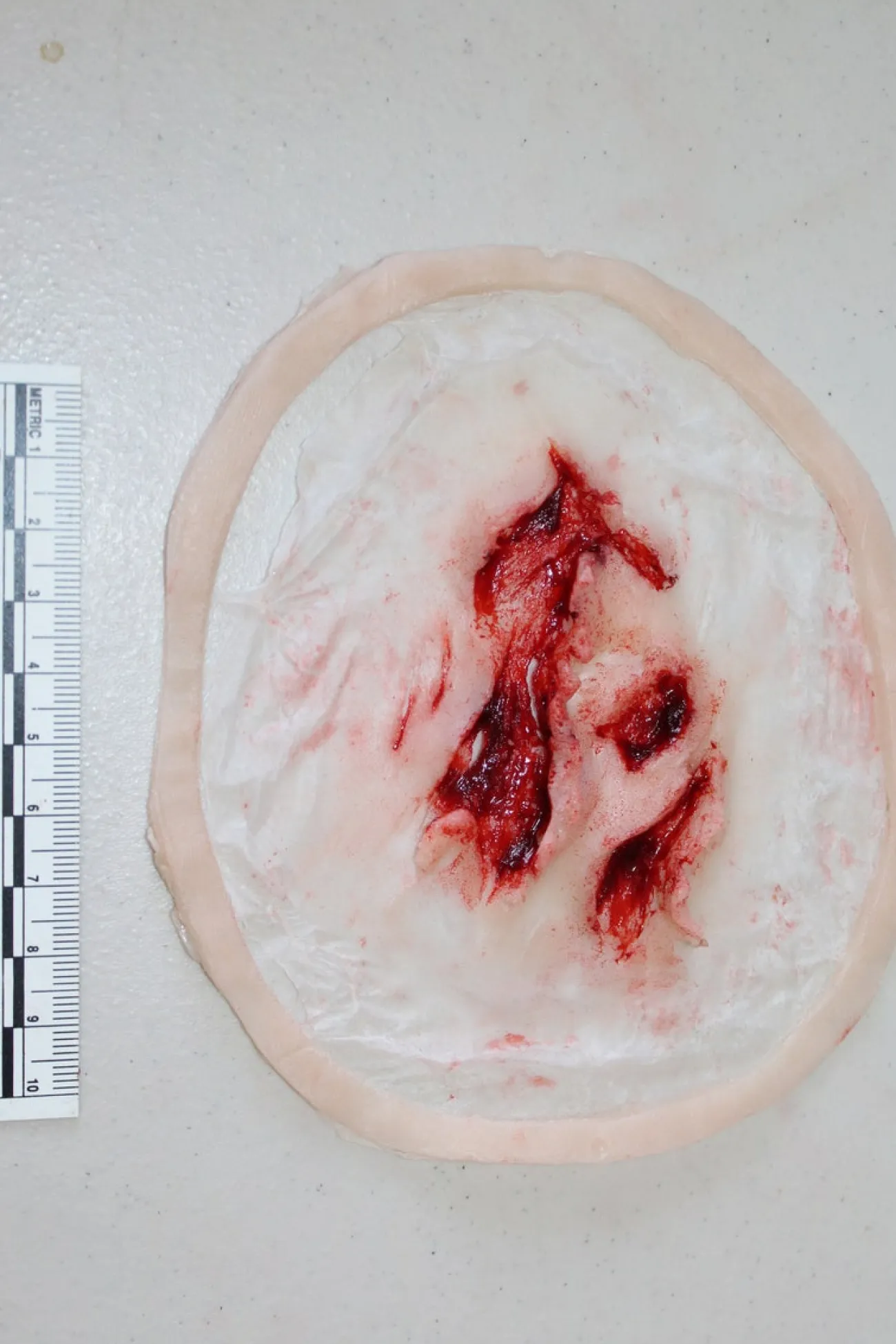 ForensicFX Studios Deep Opened Mangled Wounds Prosthetic> Halloween Accessories