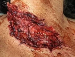 ForensicFX Studios Deep Slashed Trauma Wound Prosthetic><noscript><img width=