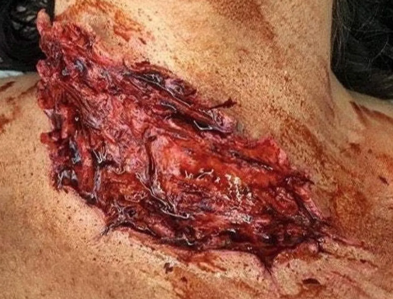 ForensicFX Studios Deep Slashed Trauma Wound Prosthetic> Halloween Accessories