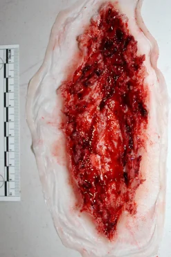 ForensicFX Studios Deep Slashed Trauma Wound Prosthetic><noscript><img width=