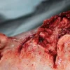 ForensicFX Studios Dog Bite Wound Prosthetic> Halloween Accessories
