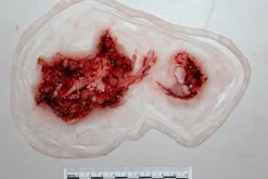 ForensicFX Studios Dog Bite Wound Prosthetic><noscript><img width=