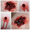ForensicFX Studios Entry & Exit Bullet Wound Prosthetic> Halloween Accessories