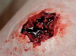 ForensicFX Studios Entry & Exit Bullet Wound Prosthetic><noscript><img width=