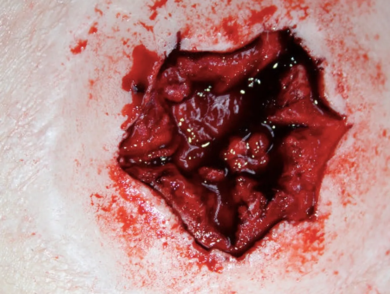 ForensicFX Studios Exit Bullet Wound Prosthetic> Halloween Accessories