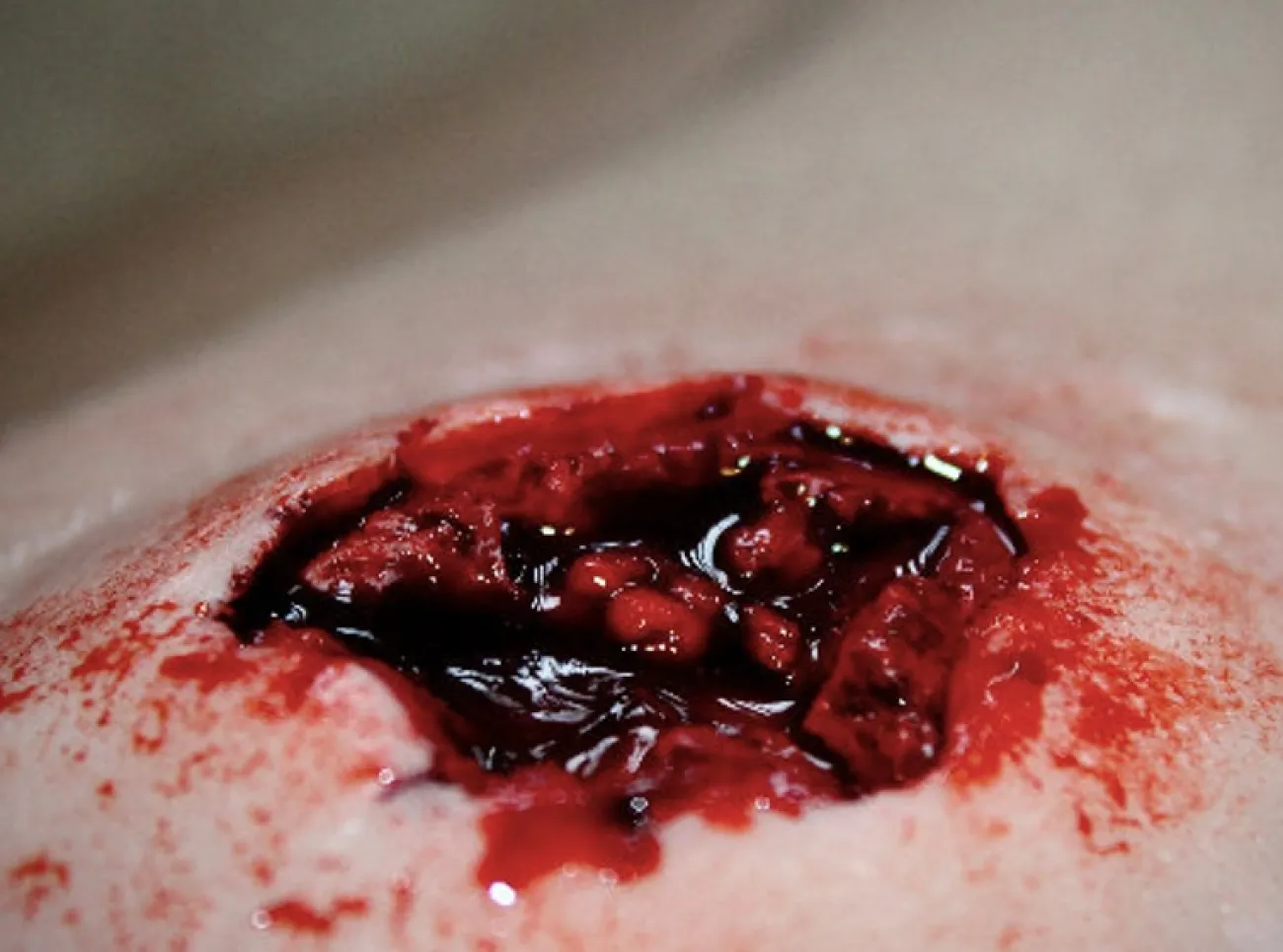 ForensicFX Studios Exit Bullet Wound Prosthetic> Halloween Accessories