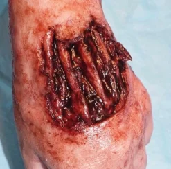 ForensicFX Studios Exposed Hand Ligaments Prosthetic> Halloween Accessories