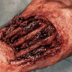 ForensicFX Studios Gorey Prosthetics Bundle><noscript><img width=