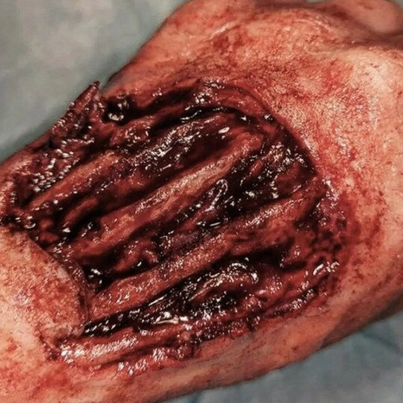 ForensicFX Studios Gorey Prosthetics Bundle> Halloween Accessories