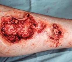 ForensicFX Studios Gorey Prosthetics Bundle><noscript><img width=