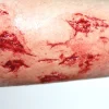 ForensicFX Studios Irregular Wound Lacerations Prosthetic> Halloween Accessories