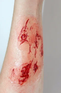 ForensicFX Studios Irregular Wound Lacerations Prosthetic></noscript> Halloween Accessories