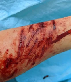 ForensicFX Studios Knife/Stab Wound Prosthetic Bundle></noscript> Halloween Accessories