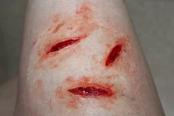 ForensicFX Studios Knife/Stab Wound Prosthetic Bundle></noscript> Halloween Accessories