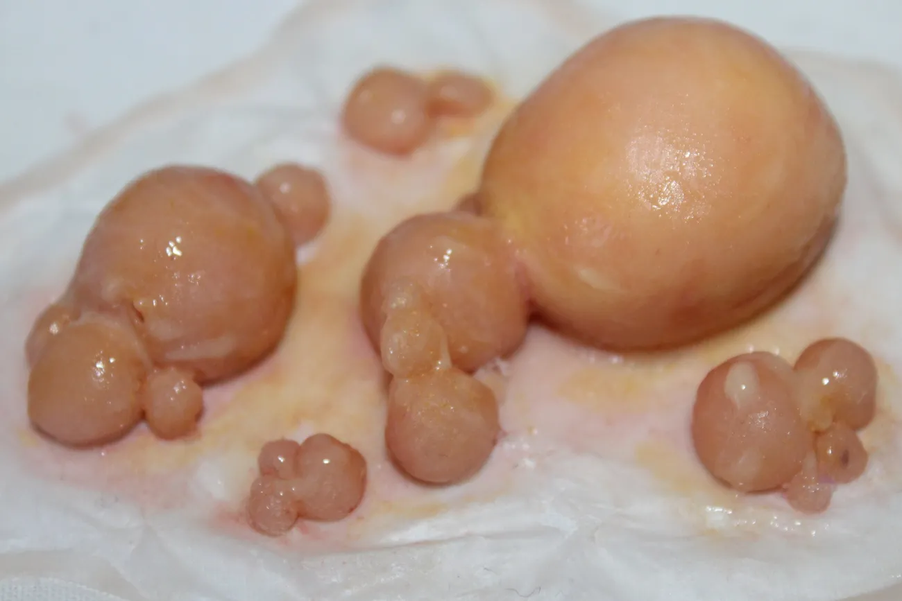 ForensicFX Studios Large Infected Boils Prosthetic> Halloween Accessories