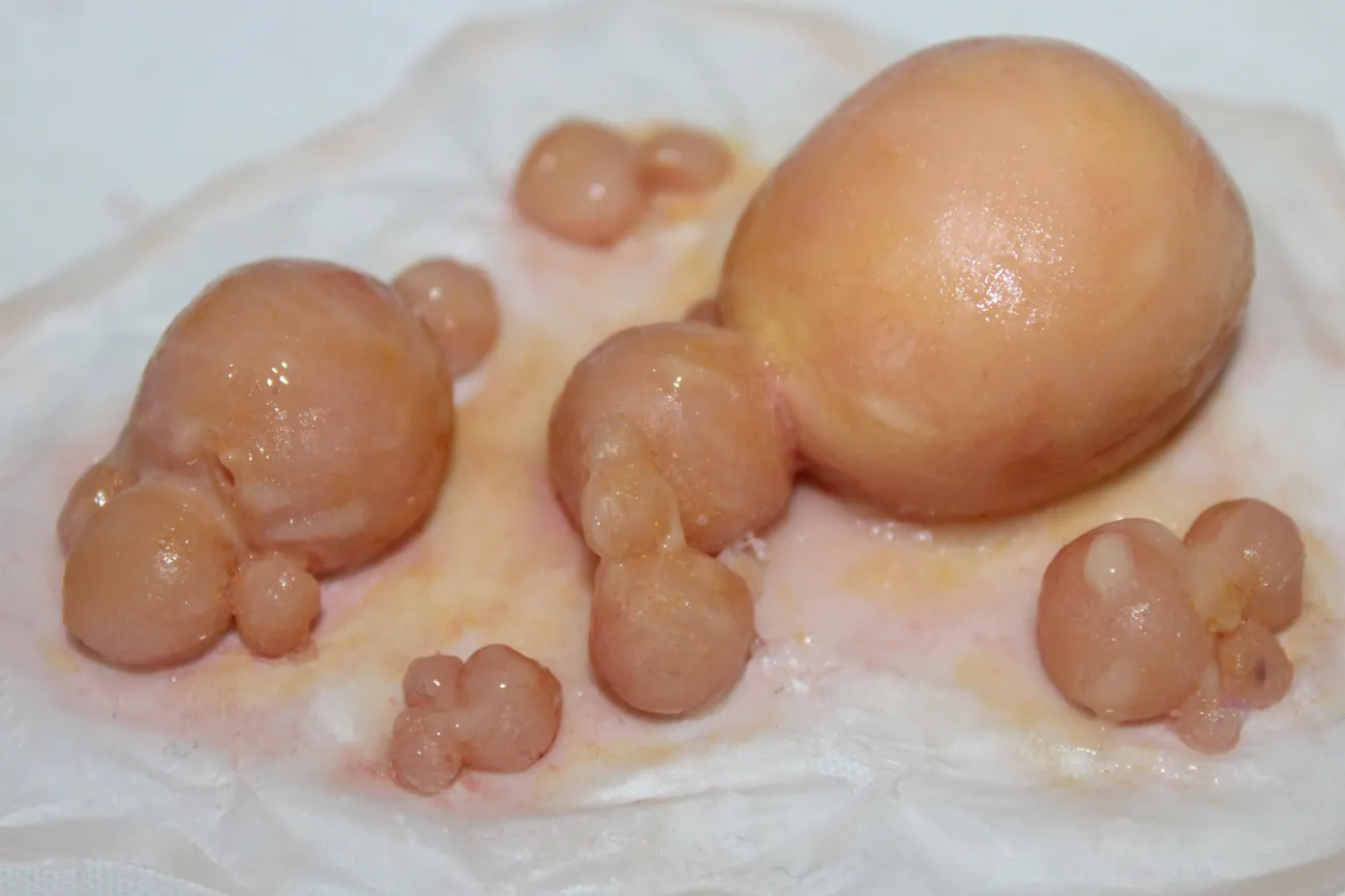 ForensicFX Studios Large Infected Boils Prosthetic> Halloween Accessories