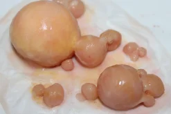 ForensicFX Studios Large Infected Boils Prosthetic><noscript><img width=