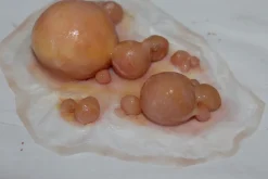 ForensicFX Studios Large Infected Boils Prosthetic><noscript><img width=