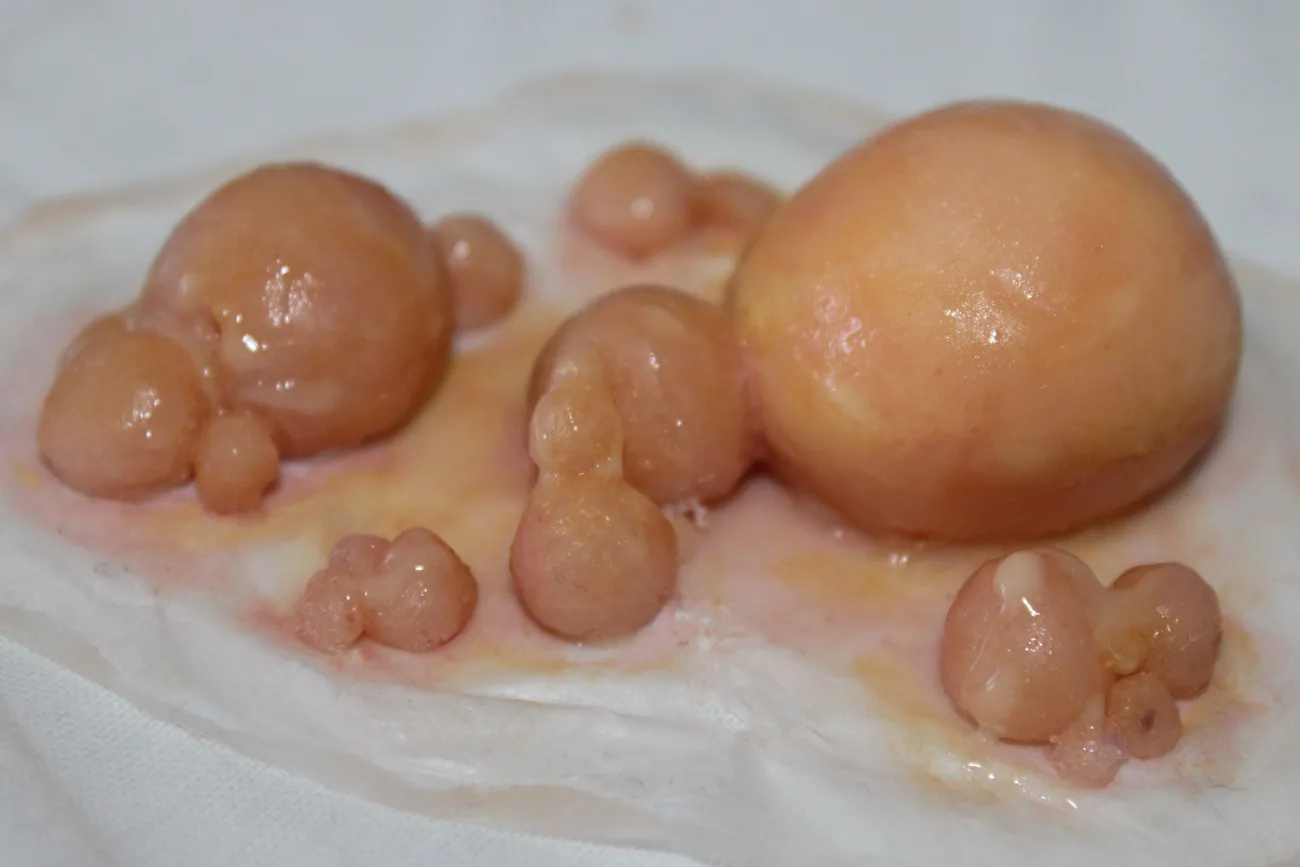 ForensicFX Studios Large Infected Boils Prosthetic> Halloween Accessories