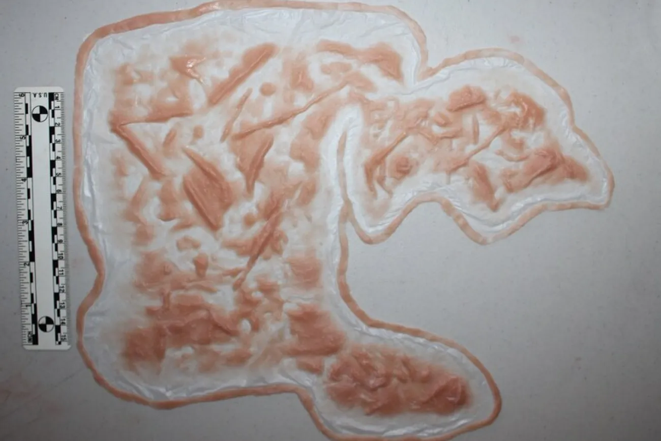 ForensicFX Studios Large Torso Skin Burn Prosthetic> Halloween Accessories