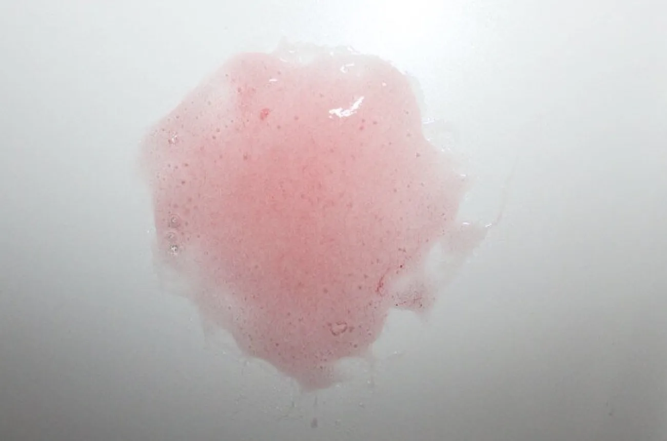 ForensicFX Studios Large Torso Skin Burn Prosthetic> Halloween Accessories