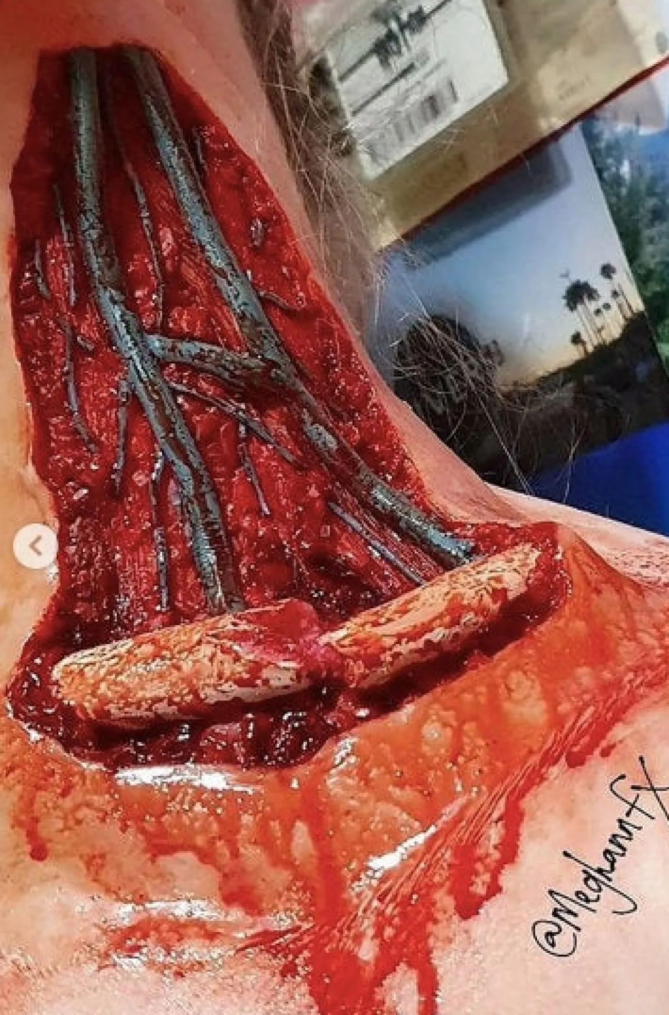 ForensicFX Studios Open Collarbone Wound Prosthetic> Halloween Accessories