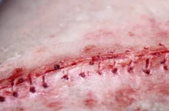 ForensicFX Studios Opened Stitches Prosthetic><noscript><img width=