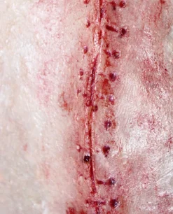 ForensicFX Studios Opened Stitches Prosthetic><noscript><img width=