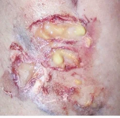 ForensicFX Studios Pus Makeup Effect Gel><noscript><img width=