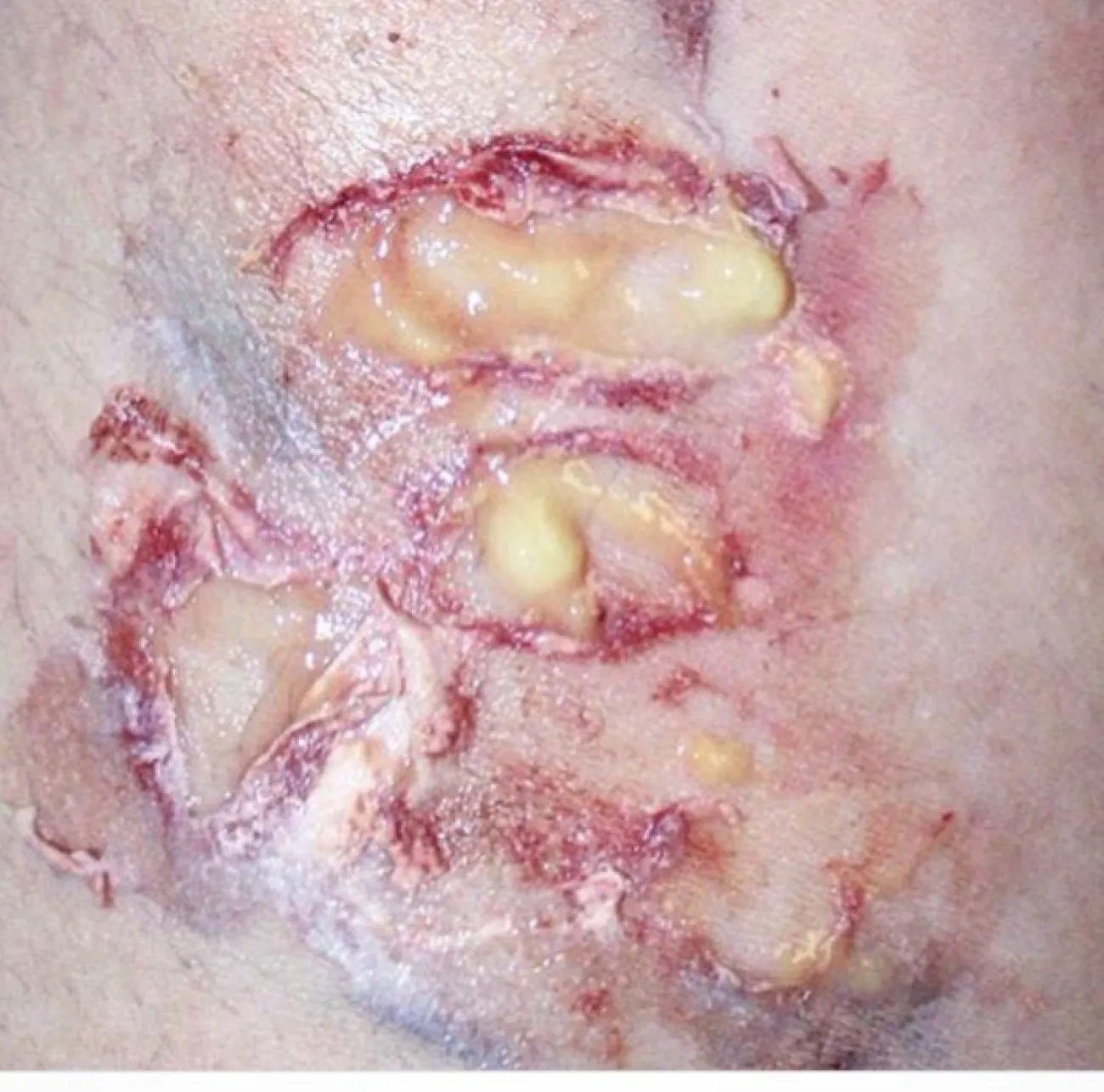 ForensicFX Studios Pus Makeup Effect Gel> Halloween Accessories