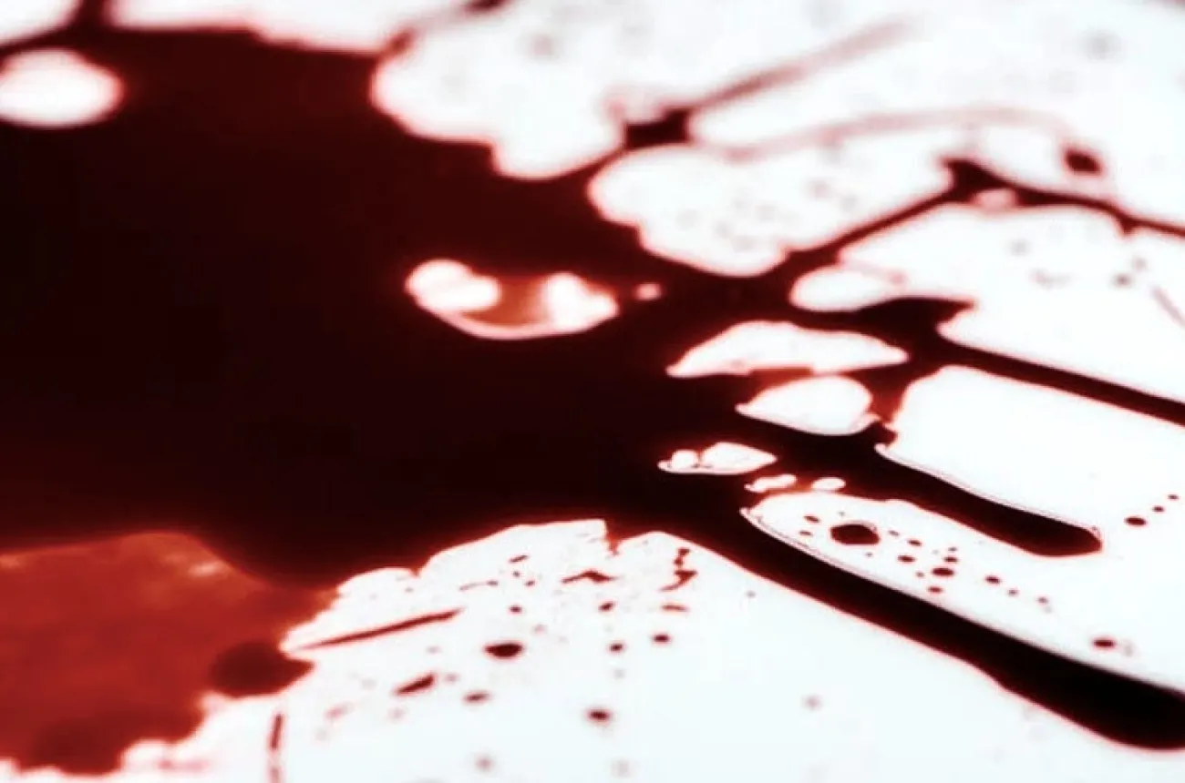 ForensicFX Studios Sfx Blood Bundle> Halloween Accessories