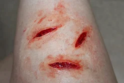 ForensicFX Studios Simple Prosthetics Bundle><noscript><img width=