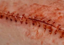 ForensicFX Studios Simple Prosthetics Bundle><noscript><img width=