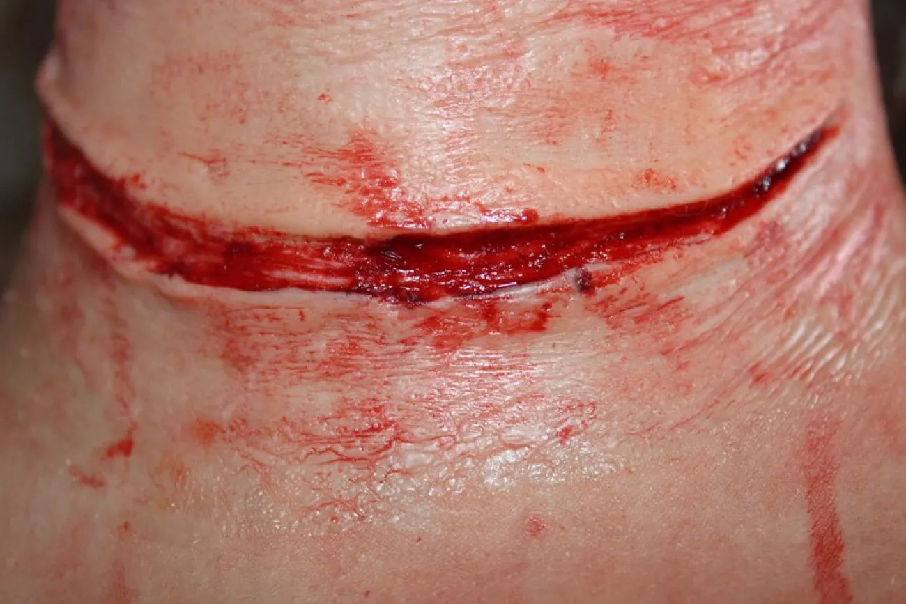 ForensicFX Studios Simple Slit Throat Prosthetic> Halloween Accessories