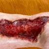 ForensicFX Studios Skin Burn Prosthetic> Halloween Accessories