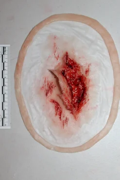 ForensicFX Studios Skin Peeling Back Wound Prosthetic><noscript><img width=