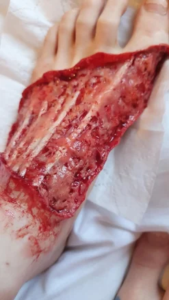 ForensicFX Studios Skinned Alive Prosthetic Bundle><noscript><img width=