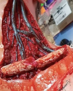 ForensicFX Studios Skinned Alive Prosthetic Bundle><noscript><img width=