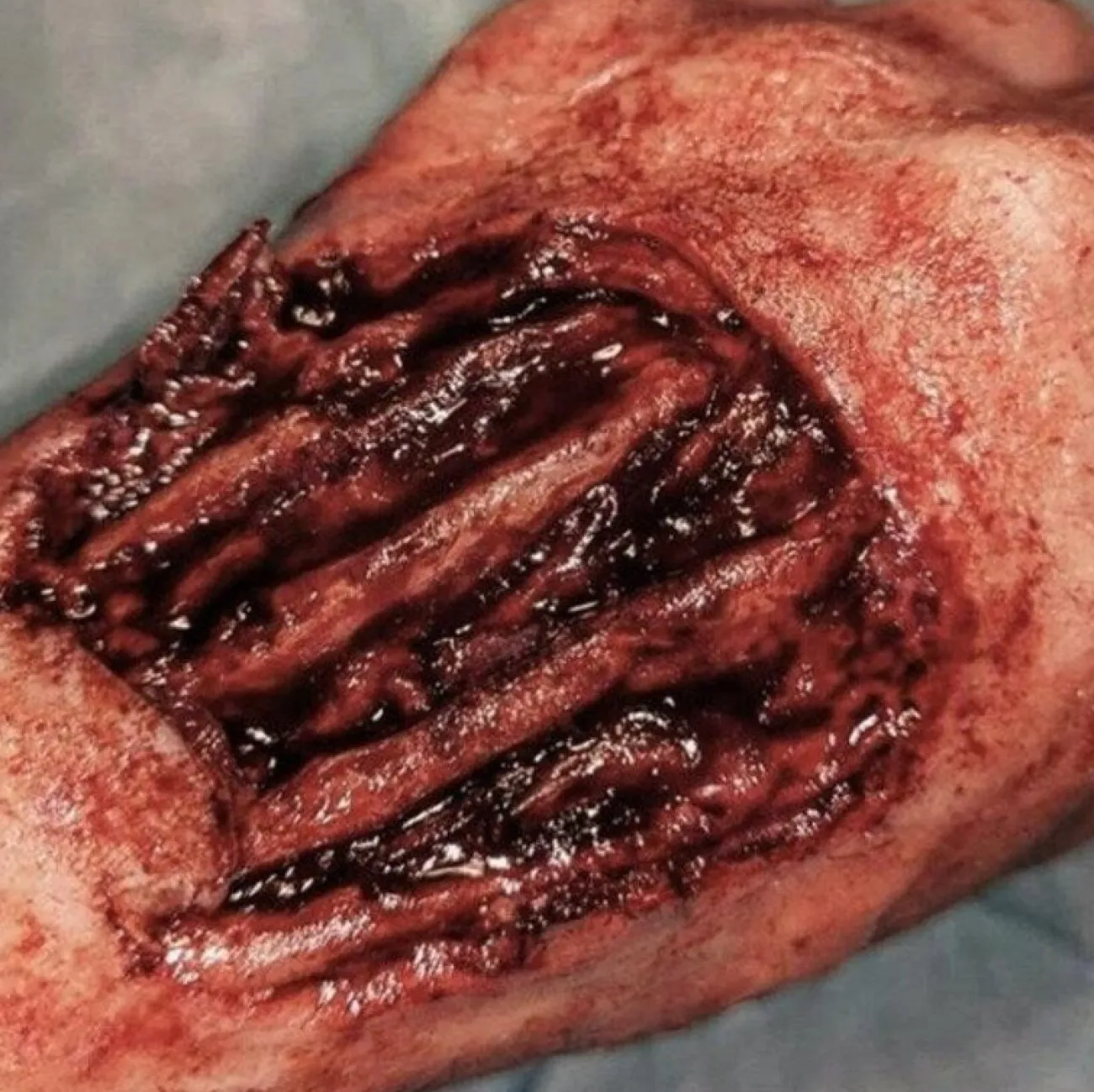 ForensicFX Studios Skinned Alive Prosthetic Bundle> Halloween Accessories