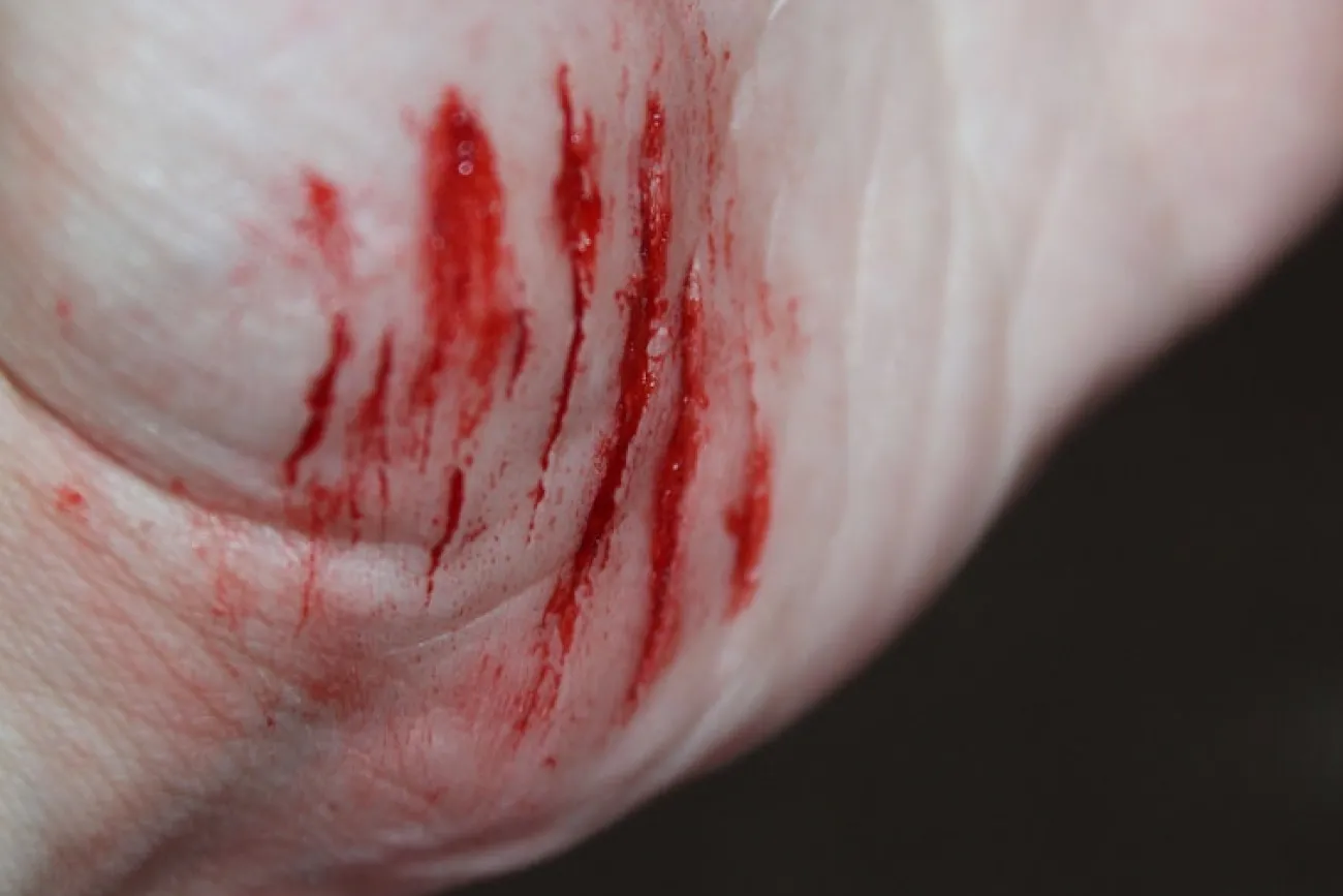 ForensicFX Studios Small Shallow Cuts Prosthetic> Halloween Accessories